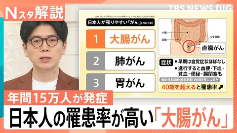 TBS NEWS DIG Powered by JNN 日本人の罹患率が高い「大腸がん」【Nスタ】