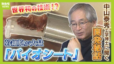 MBSニュース特集 予期せず「幹細胞」を大量に…世界初!?の再生医療技術を開発「ピカピカ光っていてびっくり」体内で生まれる『赤黒いバイオシート』治験で患者に笑顔が