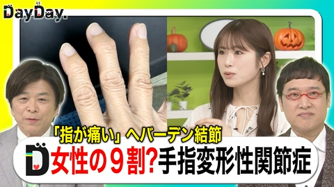 DayDay. 腰・肩・ヒザ…寒さで“関節痛”指が変形・激痛…ヘバーデン結節【ナゼ？ナゼ？】