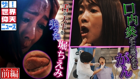 ザ!世界仰天ニュース 堀ちえみ がん発見が遅れた衝撃の理由 前編