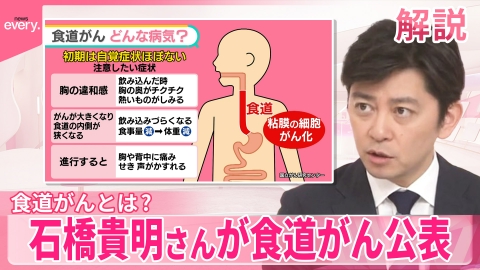 日テレNEWSセレクト 【食道がんとは？】石橋貴明さんが公表  初期は自覚症状がないことがほとんど【#みんなのギモン】