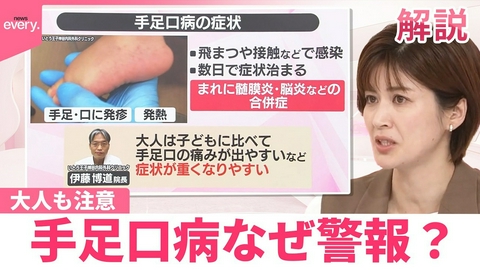 日テレNEWSセレクト 手足口病なぜ警報？ 幼い子どもを中心に夏に流行…大人も注意