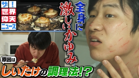 ザ！世界仰天ニュース しいたけの美味しい食べ方を真似て全身にムチで打たれたような発疹が！