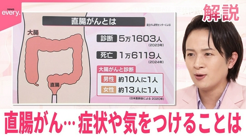 日テレNEWSセレクト 【解説】直腸がん…どういった病気なのか 症状や気をつけることは