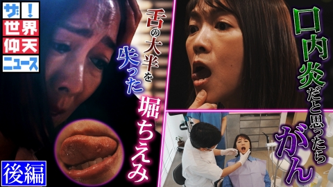 ザ!世界仰天ニュース 堀ちえみ がん発見が遅れた衝撃の理由 後編