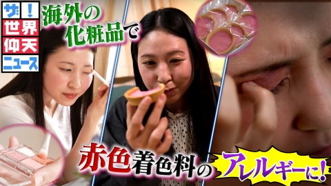 ザ！世界仰天ニュース 食べるものが恐怖になったアレルギー