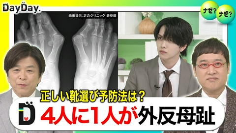 DayDay. “裸足の季節”到来 外反母趾防ぐ「正しい靴の選び方」【ナゼ？ナゼ？】