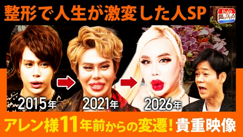 じっくり聞いタロウ～スター近況（秘）報告～ 美容整形SP！アレン様5年前から変遷（秘）貴重映像