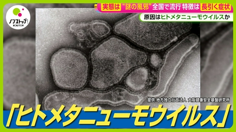 ノンストップ! “謎の風邪”流行中・・・「せき止まらない」正体は