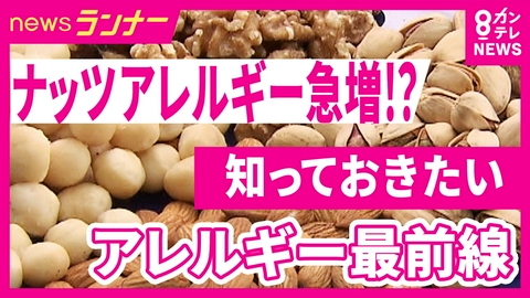 newsランナー 【なぜ増加？】10年で約10倍に急増「ナッツアレルギー」重症のリスクも　発症の低年齢化傾向も　たった“15分”で45項目を検査　アレルギー最新事情を徹底取材！