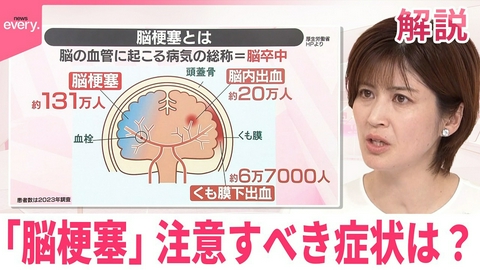 日テレNEWSセレクト 【#みんなのギモン】サンドウィッチマンの伊達みきおさんが休養 ｢脳梗塞｣注意すべき症状は？