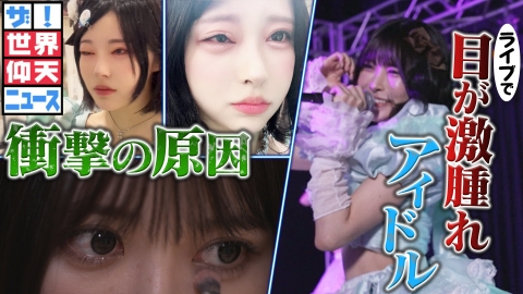 ザ！世界仰天ニュース 目が激腫れアイドル　衝撃の原因