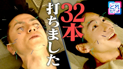 旬感LIVE とれたてっ！青木源太のキラ★おじ講座 【限定】小顔エステ②“美容鍼”肌のハリが欲しくて、鍼を打つ！