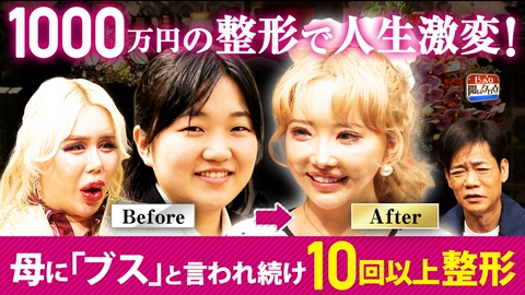 じっくり聞いタロウ～スター近況（秘）報告～ 【アレン様参戦】地獄のコンプレックスから大逆転！整形で人生アップデートSP
