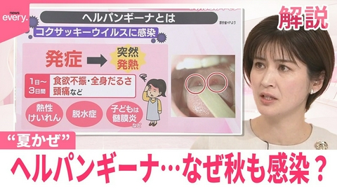 日テレNEWSセレクト 【#みんなのギモン】“夏かぜ”ヘルパンギーナ…なぜ秋も感染？ 長雨が関係か 注意することは？