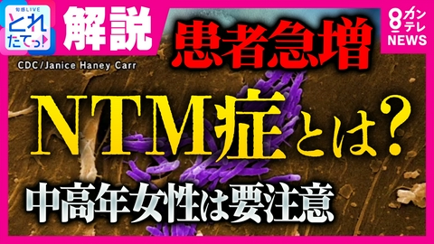 旬感LIVE とれたてっ！ 【専門医解説】「年間2000人以上が死亡」患者急増の“NTM症”とは？やせ型の中高年女性は要注意　対策方法は？　完治が困難・発症しても自覚症状なし