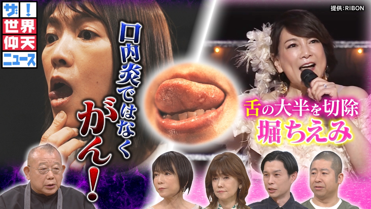 女性　手術　グロ ザ！世界仰天ニュース 5月13日(火)放送分  口内炎?命の危機…がんで舌の大半を失った堀ちえみの真実｜バラエティ｜見逃し無料配信はTVer！人気の動画見放題